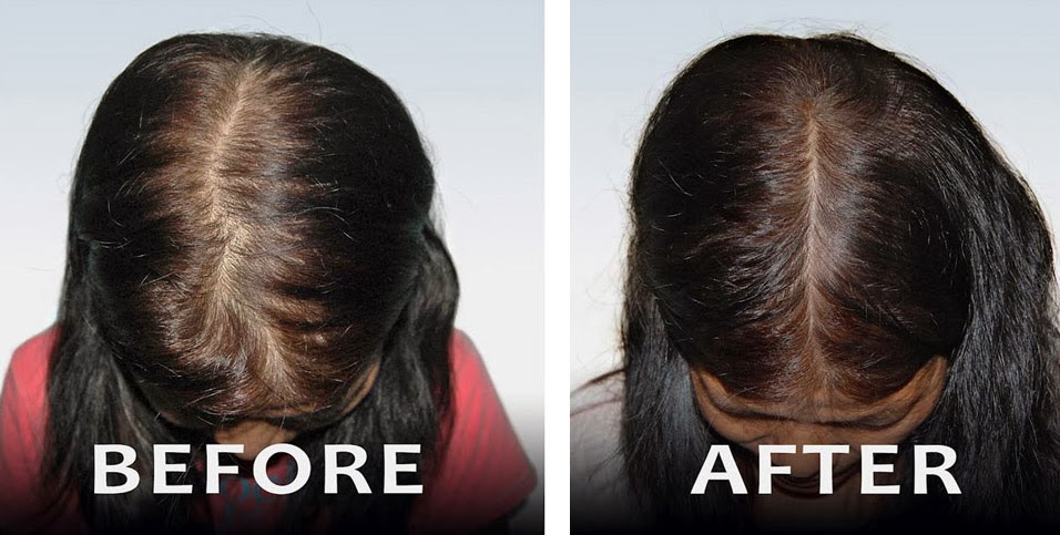 Before and After Results - Hair Ensure