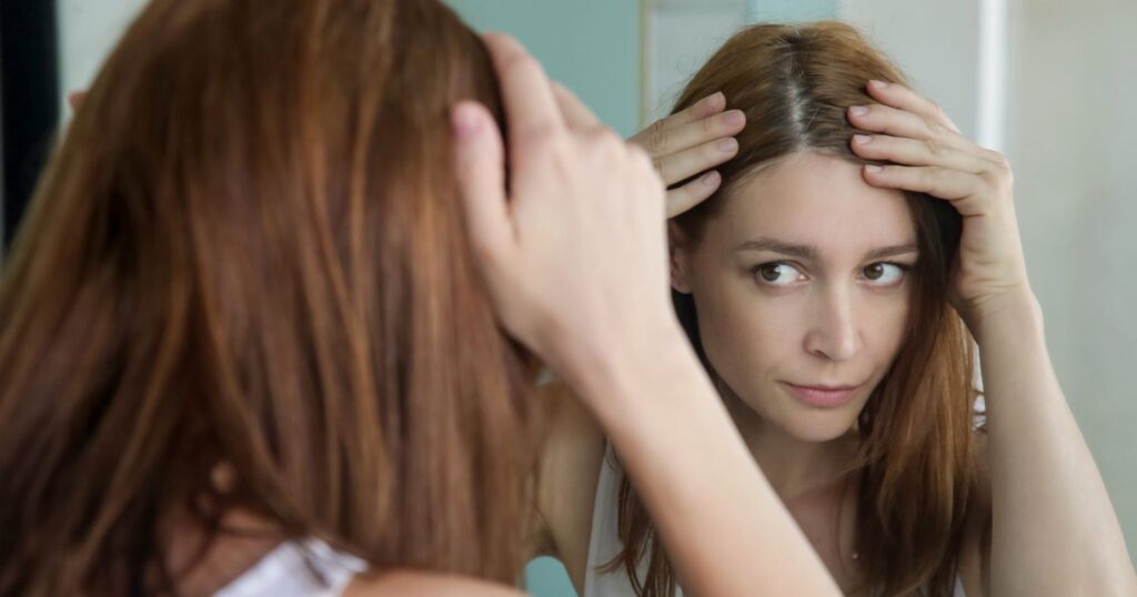 Permanent Dandruff Removal Treatment